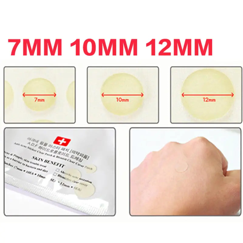 Pimple Remover Stickers